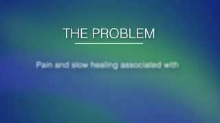 DeRoyal Negative Pressure Wound Therapy