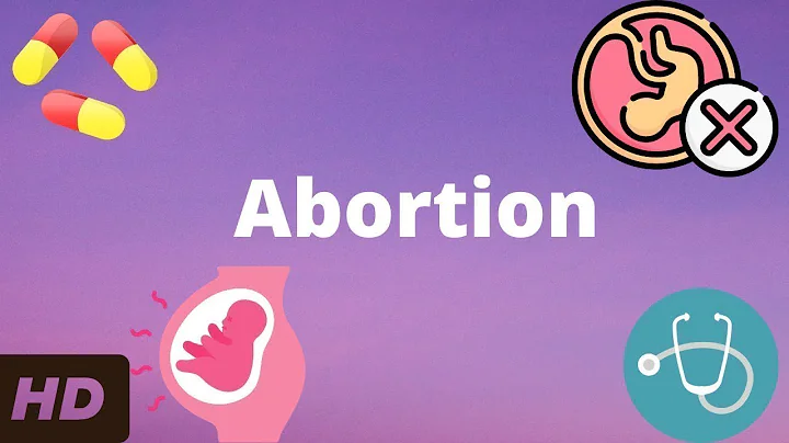 Abortion: Everything You Need To Know - DayDayNews