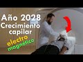 RECUPERACIÓN TOTAL de pelo electromagnética ¿Disponible en 2028?