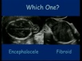Ultrasound Congenital Anomalies - fetal medicine - fetus