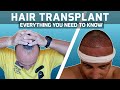 Hair transplant -  Before/during and after surgery