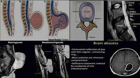 MRI of the Brain and Spine | Radiology