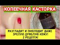 КОПЕЕЧНАЯ КАСТОРКА РАЗГЛАДИТ И ОМОЛОДИТ ДАЖЕ ЗРЕЛУЮ ДРЯБЛУЮ КОЖУ! 2 РЕЦЕПТА!