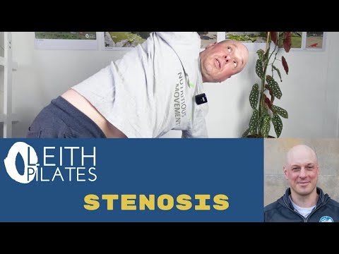 Stenosis: how to manage and prevent