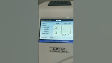 Kidney function test report #kft | Kidney function test #urea #creatinine #labtechnician #dmlt