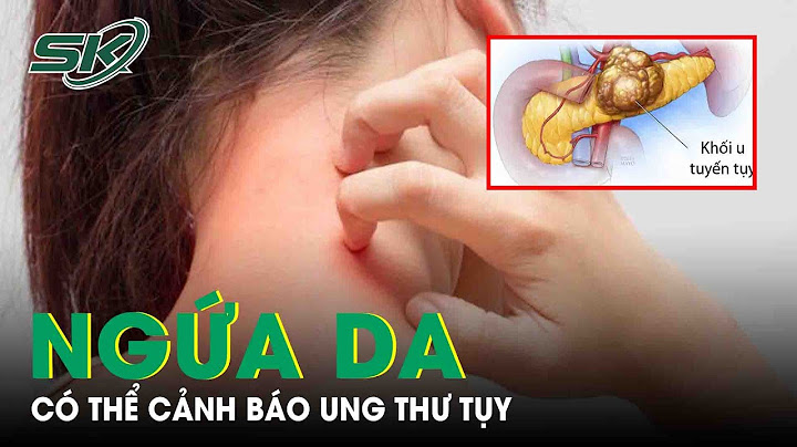 Da hay bị ngứa là bệnh gì