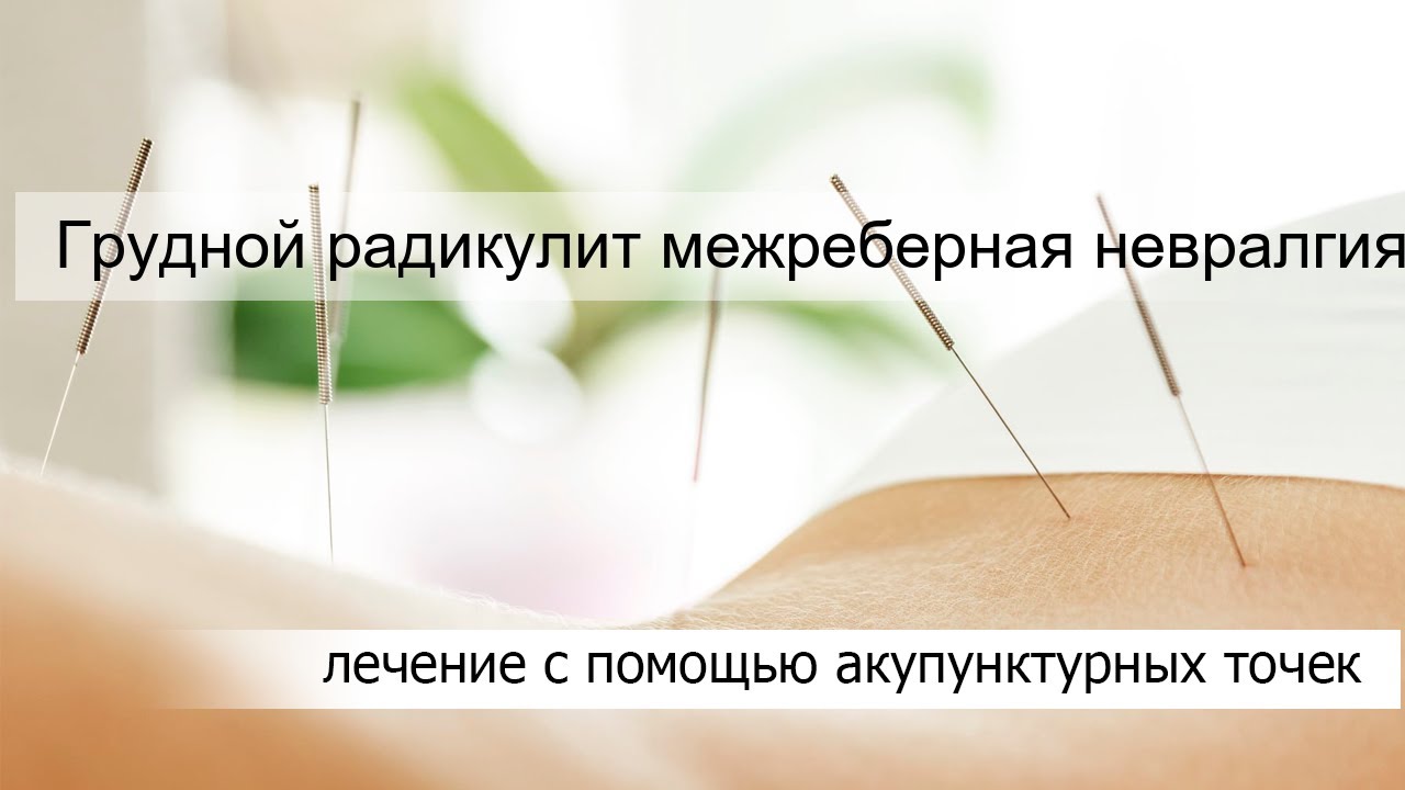 Грудной радикулит межреберная невралгия - YouTube