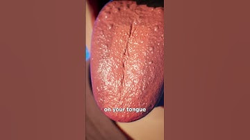 How Tongue Scraping Works 🤔