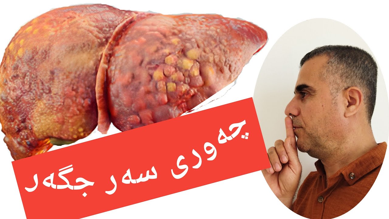 چەوری سەرجگەر..نەخۆشی جگەر..مەترسیەکانی چەوری سەرجگەر...