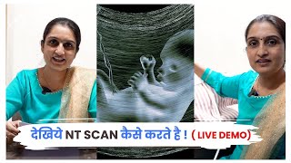 NT Scan in Hindi (Live Demo)