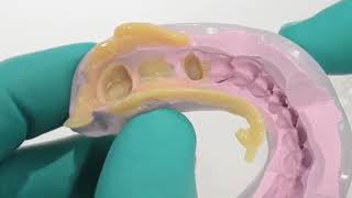 3M Protemp ESPE Mixing Tips | Endodontics in Dentistry | pinkblue screenshot 4