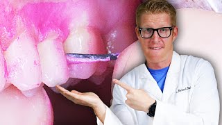 Dentist Reveals HOW TO FLOSS Your Teeth Properly & Correctly Hold Floss For Front Teeth, Back Molars