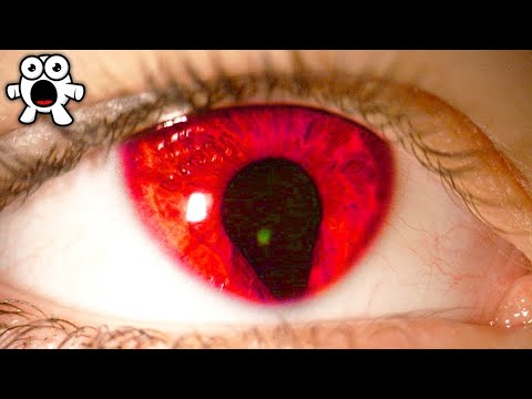 Самые Редкие Цвета Глаз у Людей