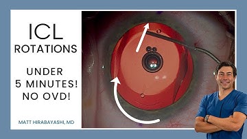 ICL Rotations (in 5 minutes)