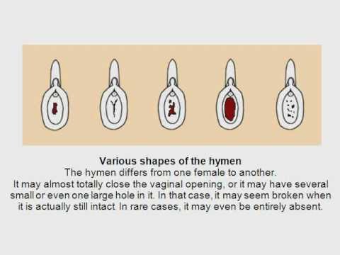 Sexology The Hymen Myths And Misconceptions Youtube