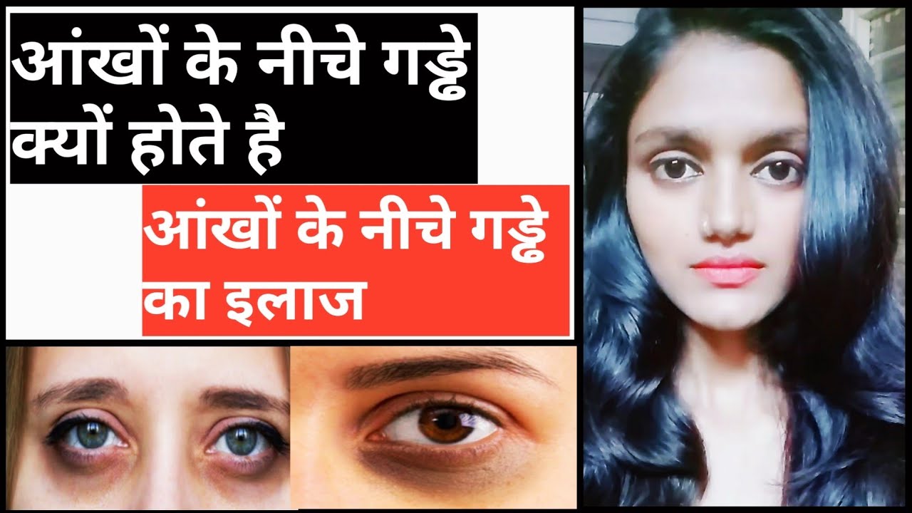 आंखों के नीचे गड्ढे का इलाज l How to treat under eye dark circles Janhavi  Raghuwanshi - YouTube