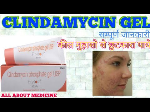 कील मुहासो (acne) की दवा Clindamycin phosphate gel (हिन्दी