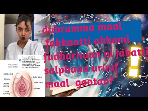 Dubrummaa Fuudhuun Akkam Salphata