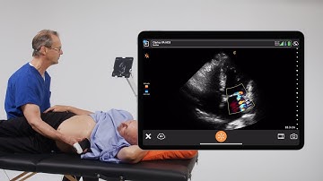 The Appearance of Mitral Regurgitation