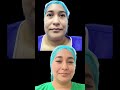 Entérate de la experiencia de ella en su lipopapada🙂