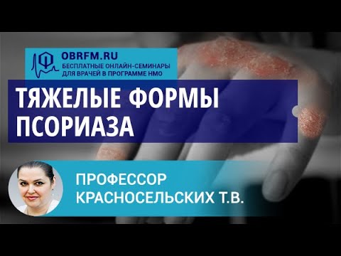 Профессор Красносельских Т.В.: Тяжелые формы псориаза