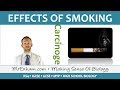 Effects of Smoking - GCSE Biology (9-1)