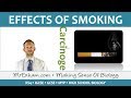 Effects of Smoking on Health