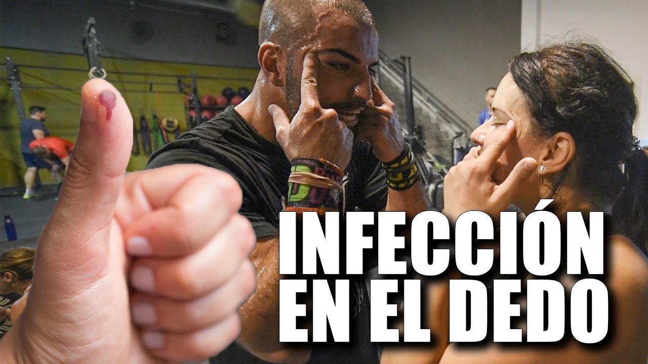 crossfit games 2018 Entrenando con una infección en el dedo... 😖