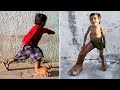 This Unique Kid was Born With a Unique Feature that Shocked the World