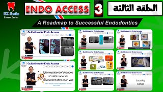 الحلقة الثالثة من ال Endo Access - III واستكمال كورس الاندو للطلاب وحديثي التخرج