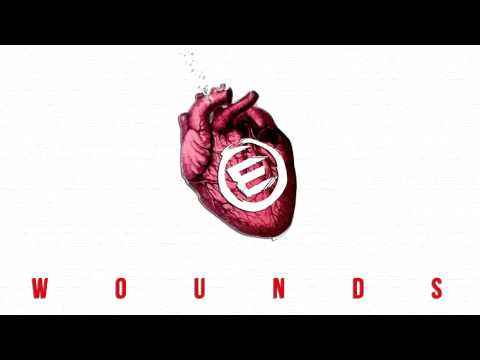 Emigra - Wounds (feat. Michael O'Driscoll)