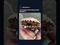 This sea creature has eyes you'll never notice #shorts #marine #mindblown