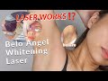 HOW I LIGHTEN MY UNDERARM + Face Belo Angel Whitening Laser Treatment