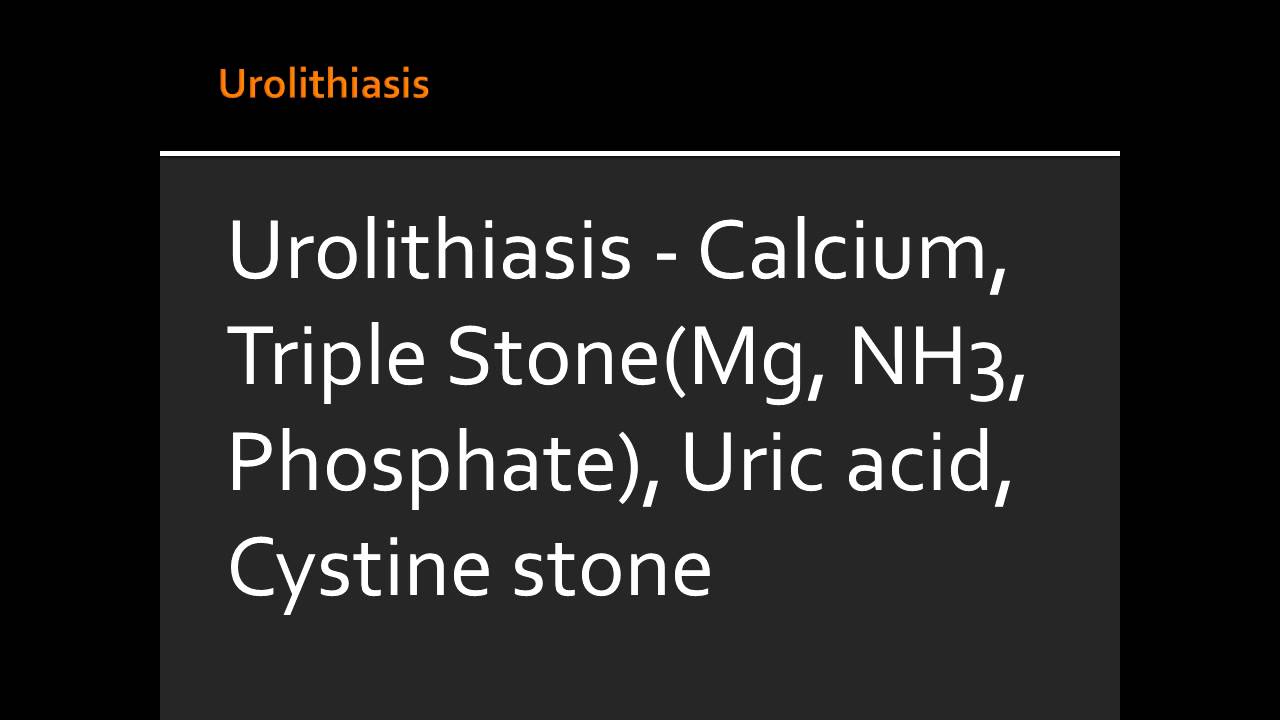 dohányzás és urolithiasis