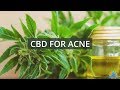 CBD for Acne