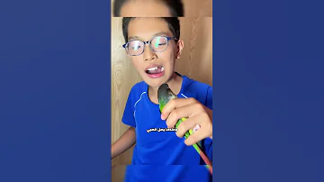 صبي يستخدم ببغاء لخلع الأسنان 