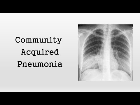 Video: Community-acquired Pneumonia: What Is It, Symptoms, Treatment Of The Disease