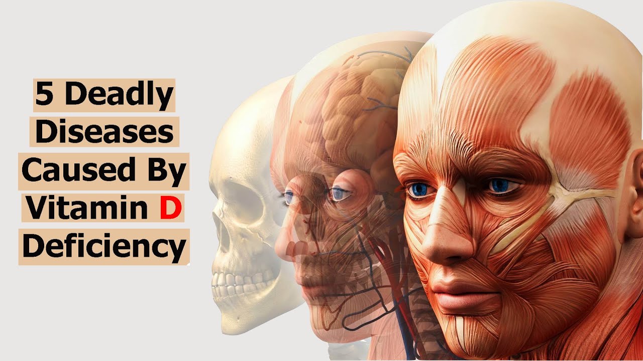 5 Deadly Diseases Caused By Vitamin D Deficiency YouTube