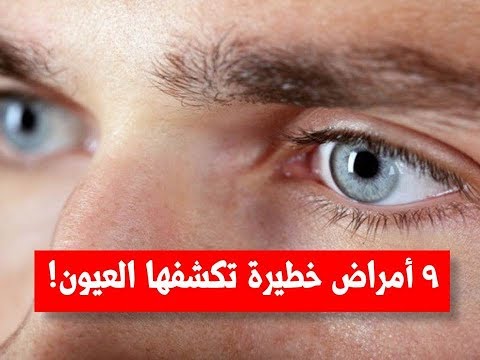 فيديو: ما هي الأمراض التي يمكن أن تخبرنا بها العيون