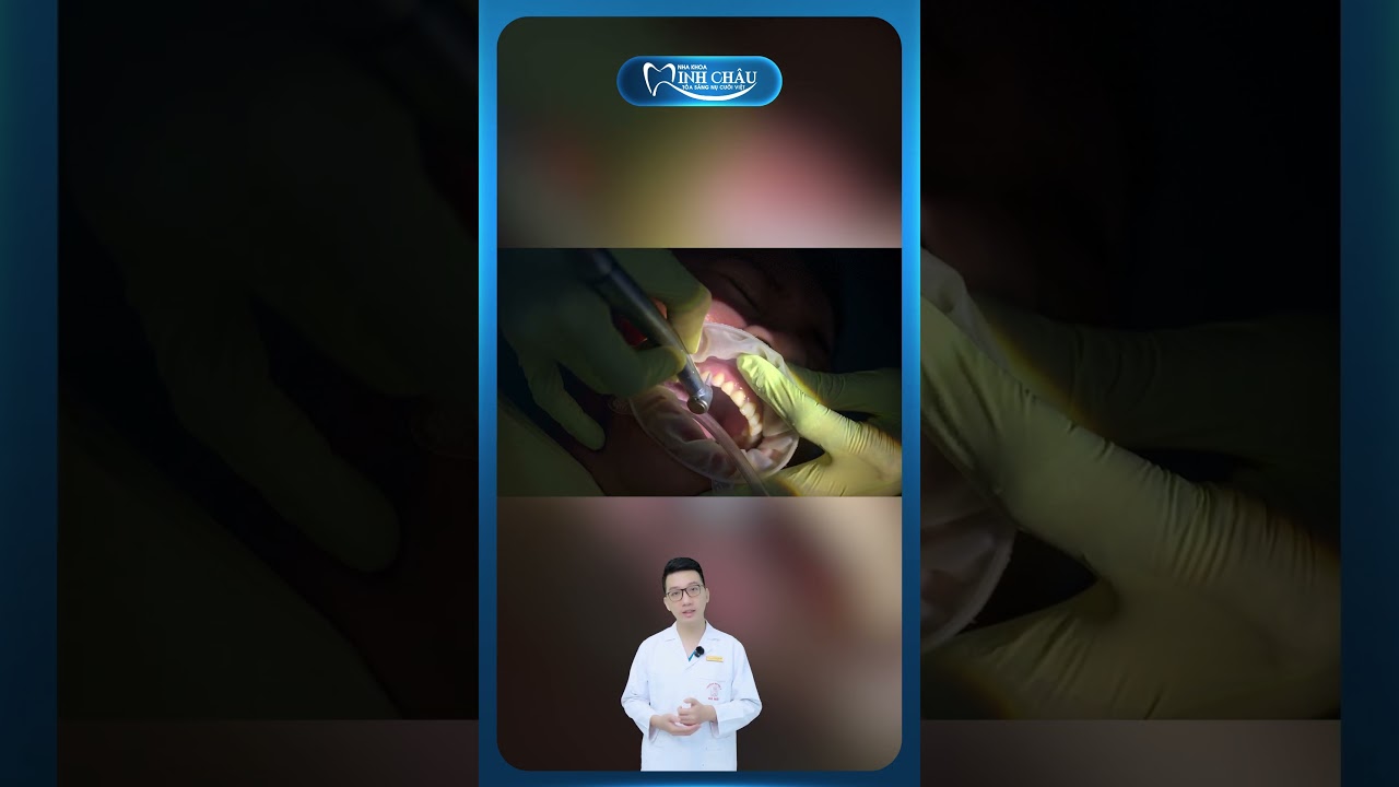 Vệ Sinh Răng Sau Khi Tháo Mắc Cài Niềng Răng | Nha Khoa Minh Châu