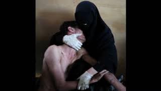 Crystal Castles - Transgender [GRIMSLATE REMIX]