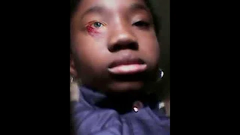 I got beat up