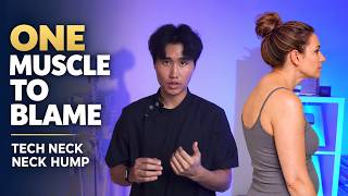 Neck Hump, Tech Neck, Pain — One Muscle Is to Blame