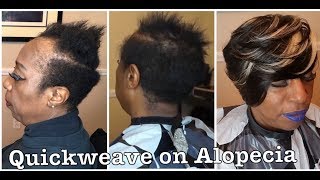 HOW TO QUICK WEAVE ON A CLIENT WITH ALOPECIA- Step by Step AUDIO VERSION| LENA B