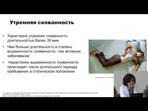 Лучихина Е.Л.: Лечение анкилозирующего спондилита. Школа для пациентов в Московской области