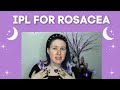 My Experience Treating Rosacea with IPL