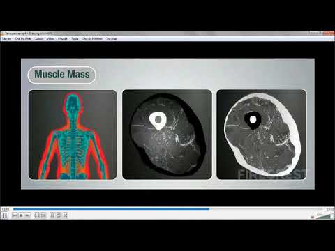 Trình Bệnh  Sarcopenia Sát Thủ Thầm Lặng Ở Bệnh Nhân COPD 18/6