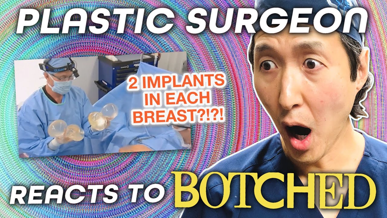 Woman with TWO implants stacked in each breast begs Botched docs