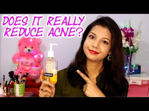 DOES IT REALLY REDUCE ACNE/PIMPLES? | NEUTROGENA OIL FREE ACNE FACEWASH REVIEW|  KRISHNA ROY MALLICK