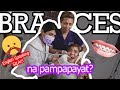 NAGPABRACES PARA MAGPAPAYAT?! (english speaking nakakaloka)